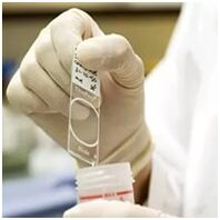Papilomas vīrusa infekcijas diagnoze