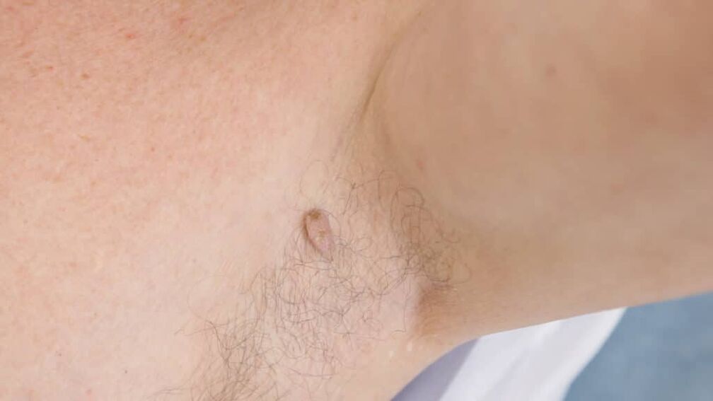 Filma Papilloma